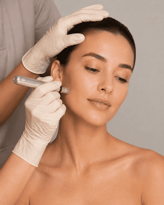 A clinician in cream gloves steadies a client’s head and holds a pen-shaped microneedling handpiece against her cheek.